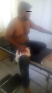 ROJA EL CONDUCTOR EN ESTADO DE EBRIEDAD RECIBIENDO ATENCION MEDICA EN URGENCIAS