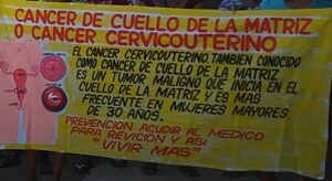Marquelia Mujeres de 25 a 65 años de edad deben realizarse el examen