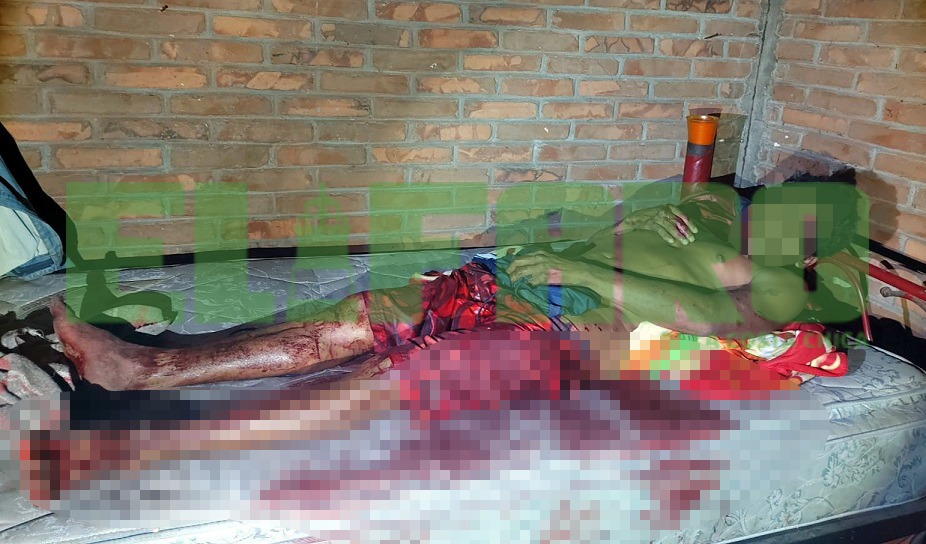 ROJA CONSTANTINO ARELLANO SILVERIO, TRAS SER LESIONADO