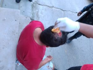 ROJA Nicolás Peñaloza Agama siendo atendido (1)