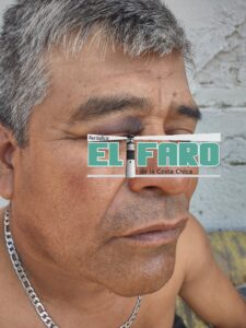 ROJA Dijo que con una escopeta fue golpeado (1)