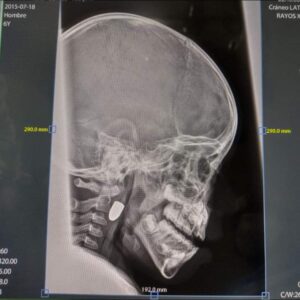 ROJA as radiografiás del niño (2)