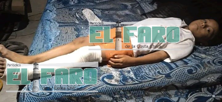 ROJA EL MENOR
