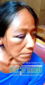 ROJA YULMA DE LA CRUZ GUTIÉRREZ