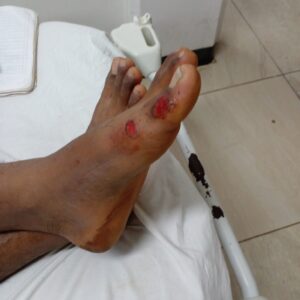 ROJA SUS LESIONES