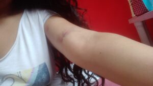 ROJA LAS AGRESIONES (6)