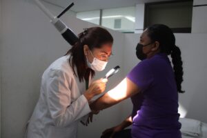 sociales melanoma lentiginoso