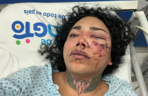 ROJA Así quedó la influencer